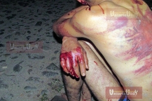 “Levantan” a sujeto que dijo llamarse Héctor Gustavo Rojas en Ixtapa y lo arrojan muy golpeado en “Las Gaviotas”