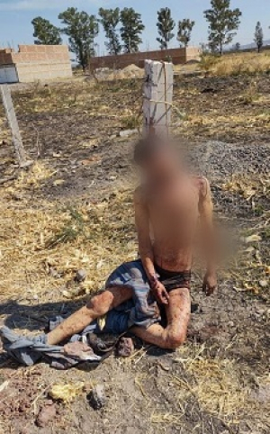 Lo golpearon, torturaron y amarraron en un poste de cerca