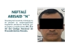 Trasladaba a una menor en un vehículo en El Coapinole para abusar de ella; ya está vinculado