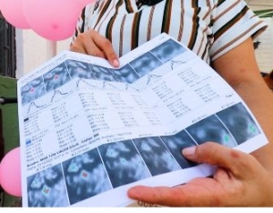 ¡Histórico! Más de 200 mujeres se beneficiaron con mastografías gratuitas