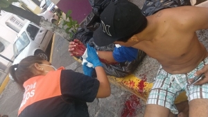 Se metió a una casa, huyó en moto y luego se accidentó